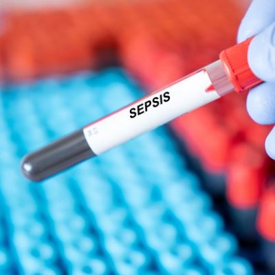 A gloved hand holds a pipette containing blood, with a label that reads Sepsis.